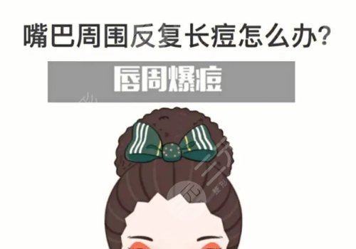 口周一直長(zhǎng)痘痘什么原因？