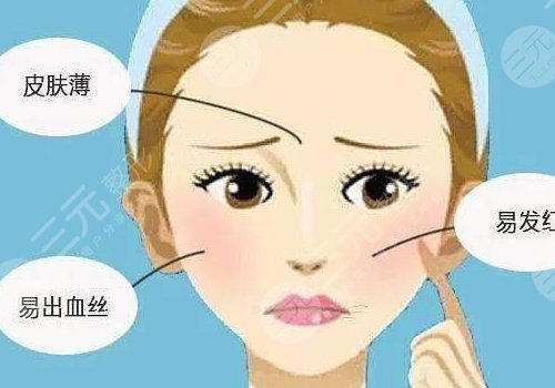 紅血絲皮膚用什么護膚品？3