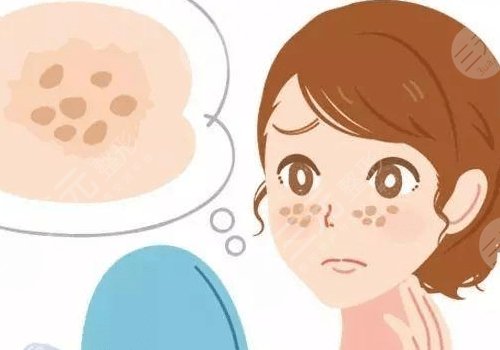 臉上長(zhǎng)了色斑是什么原因造成的?