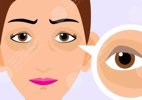 有了黑眼圈怎么消除？