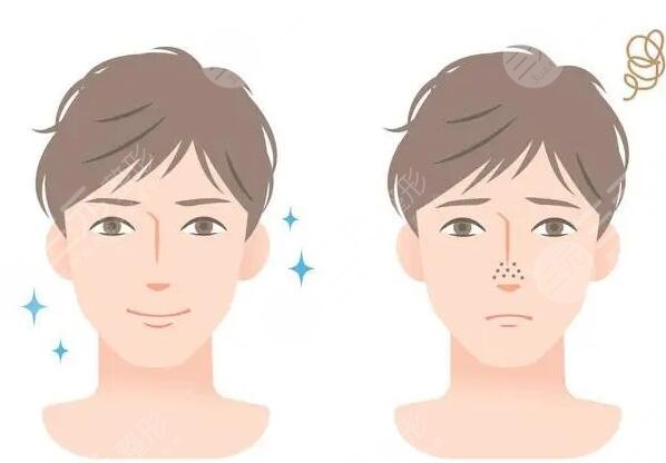 男士皮膚美白的方法和技巧有哪些？擁有健康男子氣概膚色~