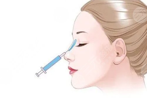 愛貝芙隆鼻會變寬嗎