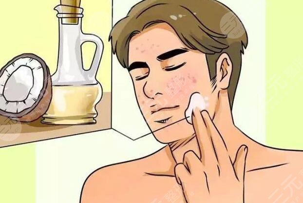 醫(yī)美祛痘技術(shù)