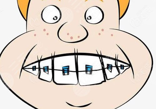 牙套價格一般是多少錢一個