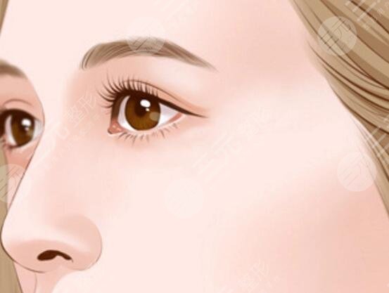 墊鼻梁有什么后遺癥嗎？手術(shù)伴隨的風(fēng)險和副作用該怎么規(guī)避？