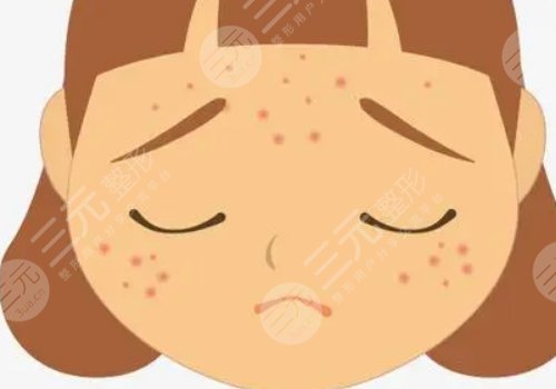 如何去除臉上的青春痘？