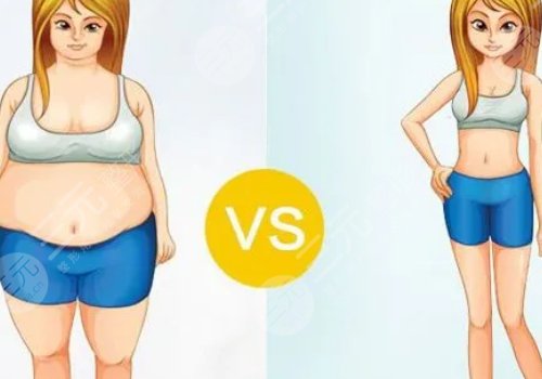 產(chǎn)后吸脂減肥好嗎？