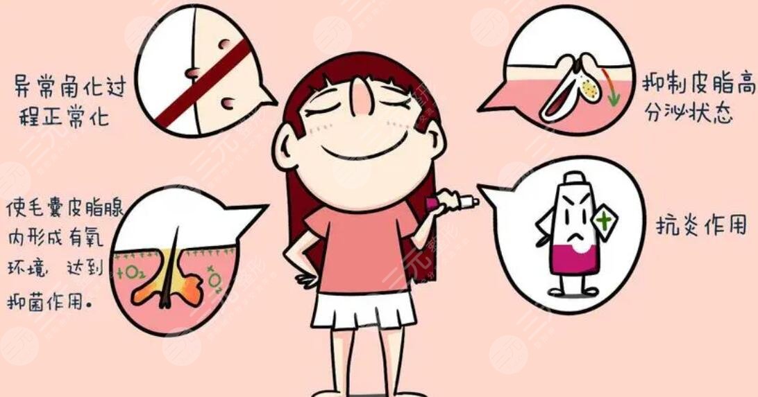 激光磨皮緩解需要注意哪些問題?