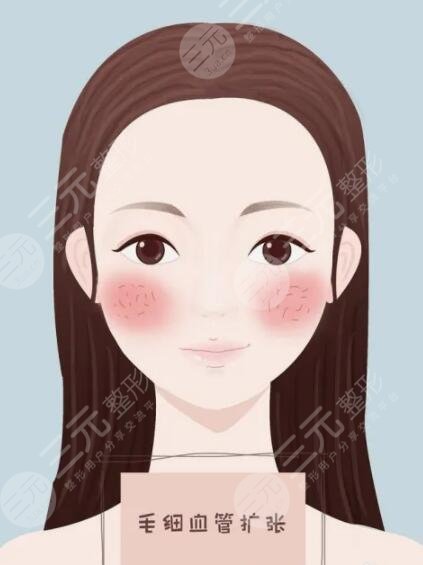 彩光祛紅血絲注意事項(xiàng)