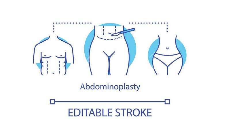 腹壁整形術(shù)多少錢?