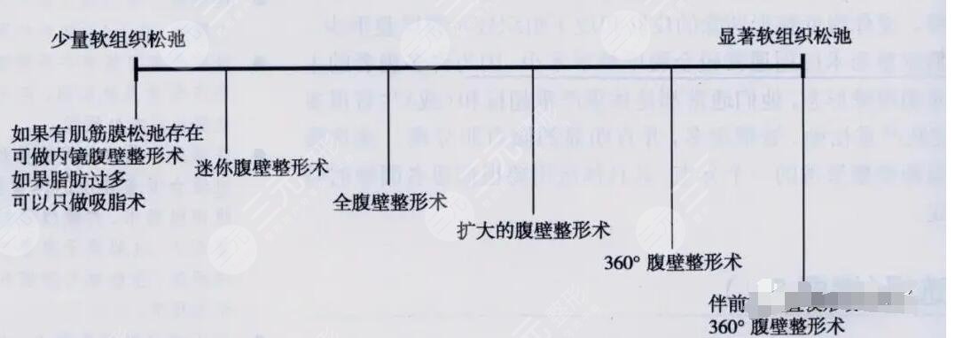 腹壁整形術(shù)多少錢?