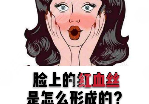 怎么減少紅血絲的產(chǎn)生？