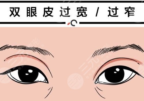 雙眼皮修復(fù)大概多少錢呢？