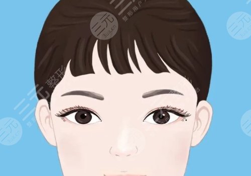 雙眼皮修復(fù)大概多少錢呢？
