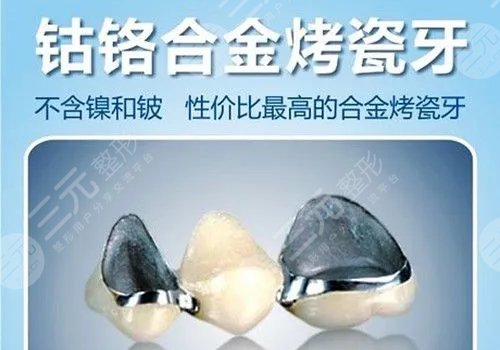 烤瓷牙多少錢一顆價格表2023