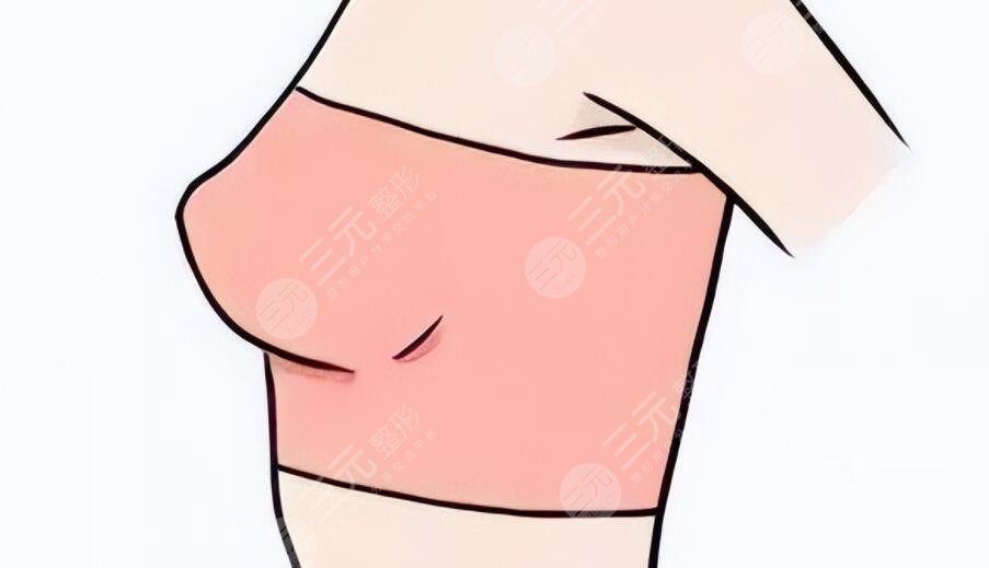 魔滴假體隆胸手術(shù)之后需要注意什么?