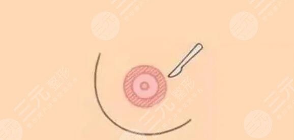 成都高新后美醫(yī)療美容醫(yī)院項(xiàng)目科普