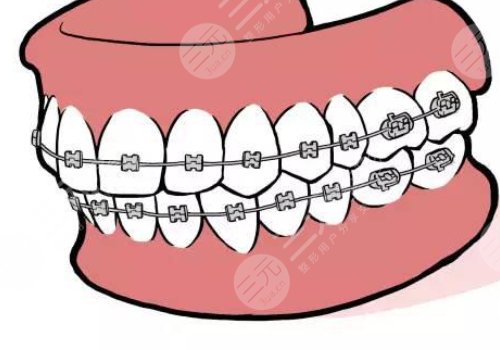 牙齒矯正什么年齡段好？