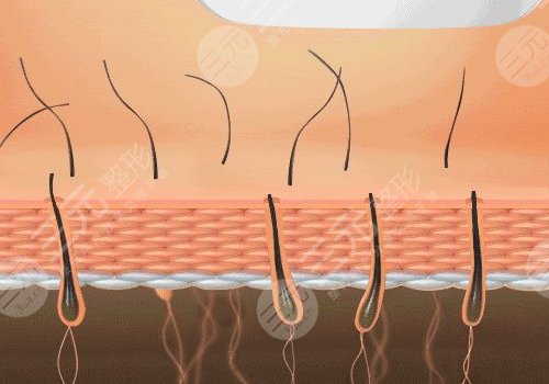 脫毛儀哪個牌子效果比較好？