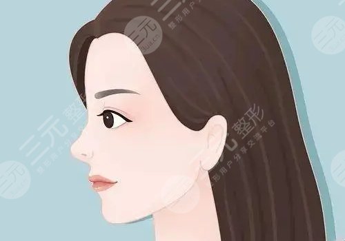 玻尿酸隆鼻子可以維持多久？