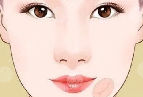 像素射頻儀器祛疤有用嗎？