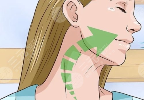 頸紋特別深怎么去除？