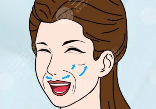 拉皮手術多大年齡做合適？