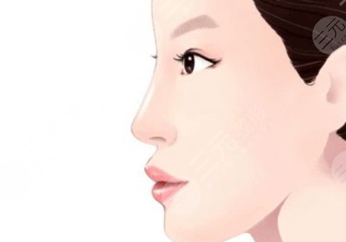 肋骨隆鼻肋骨取了對(duì)身體有影響嗎？