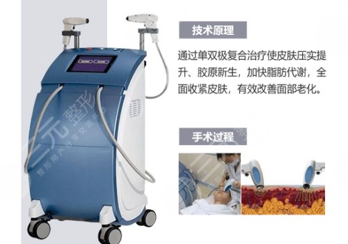 深藍射頻做一次有效果嗎？