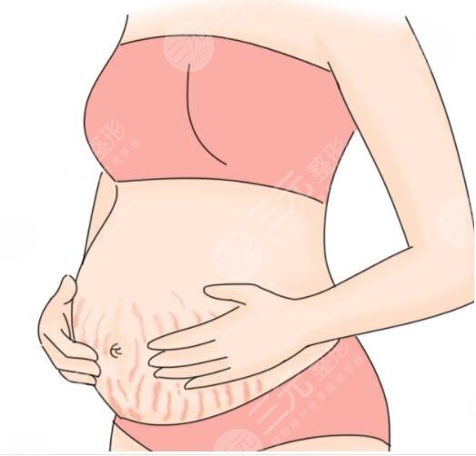 什么是橄欖油?有哪些營養(yǎng)價(jià)值?