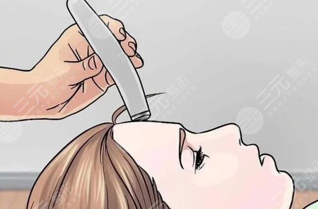 毛孔粗大激光緩解怎么樣?