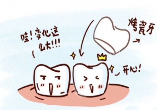 鈦合金烤瓷牙多少錢(qián)一顆？