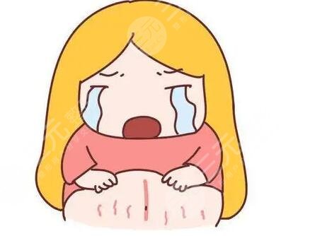 橄欖油預防妊娠紋有效嗎?