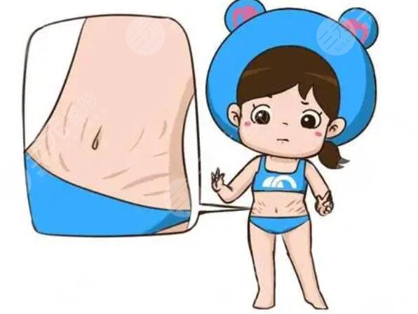 橄欖油預防妊娠紋有效嗎?