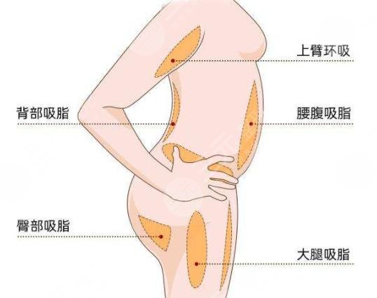 怎么樣才可以溶脂減肥?