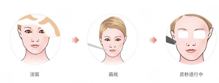 美白注射，水光注射管用嗎?