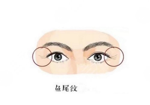 怎么樣去除眼部皺紋？