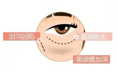 眼周抗衰綜合多少錢做一次？