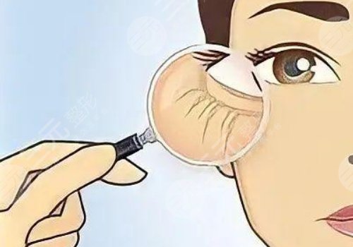 眼周抗衰綜合多少錢做一次？