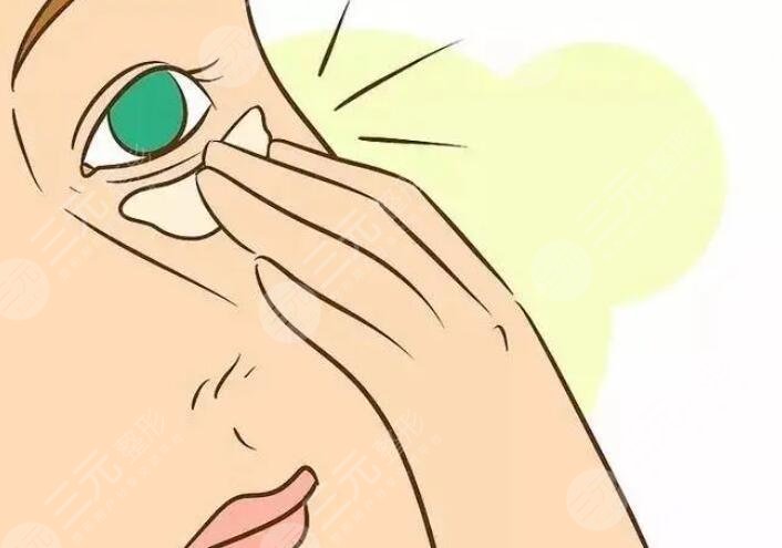 怎樣防止魚尾紋及保養(yǎng)方法