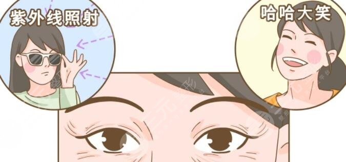 怎么才能去掉魚(yú)尾紋眼角的魚(yú)尾紋，提供4種方案給你！