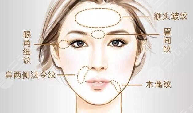 面部下垂做哪種醫(yī)美手術(shù)好?