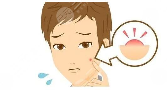 緩解青春痘費用多少錢？哪些醫(yī)美方法見效快？