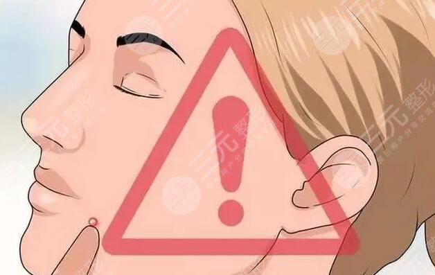 紅藍光祛痘注意事項有哪些?