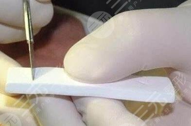 膨體隆鼻如何護理?