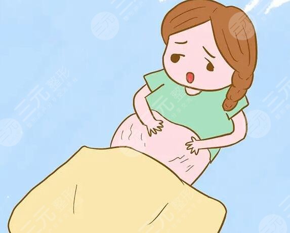 5個妙招幫助消除妊娠紋