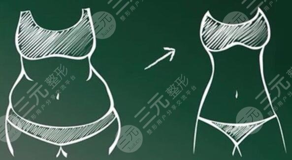 光纖溶脂是怎么做的？有哪些優(yōu)勢(shì)？術(shù)后護(hù)理事項(xiàng)怎么做？