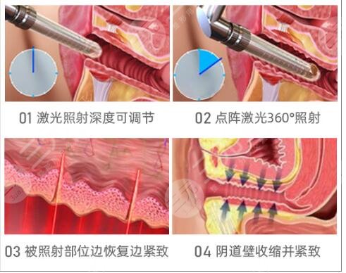 女人私密緊致產(chǎn)品可以用嗎?