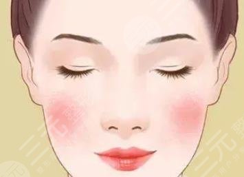 紅血絲激光多少錢