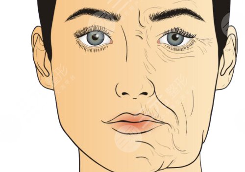 深藍(lán)射頻間隔多久做一次？